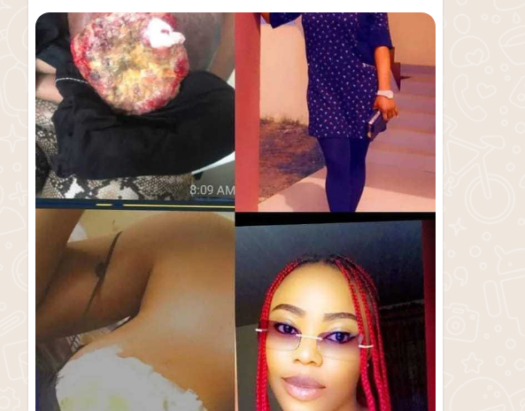 Call to save Miss Eze Nelly from death