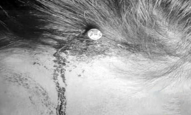 Faith healer' hammers two inch nail into head of woman pregnant with a girl to enable her 'give birth to a boy'