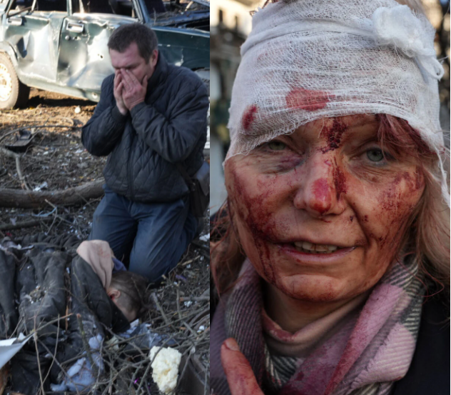 Heartbreaking scenes as deadly missile strikes plunge Ukraine into bloodshed after Putin declared war on Ukraine