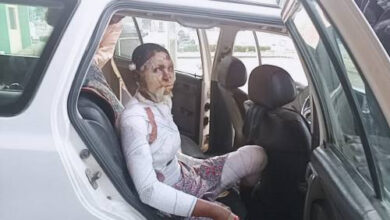 Jealous man allegedly sets his wife ablaze in Adamawa