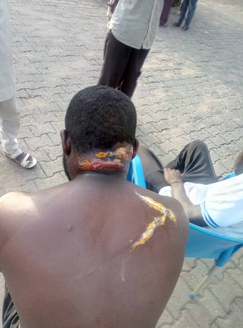 Unknown Assailants Attack 2/1 New Site Kubwa, Wound Scores (Graphic Pics) - Crime