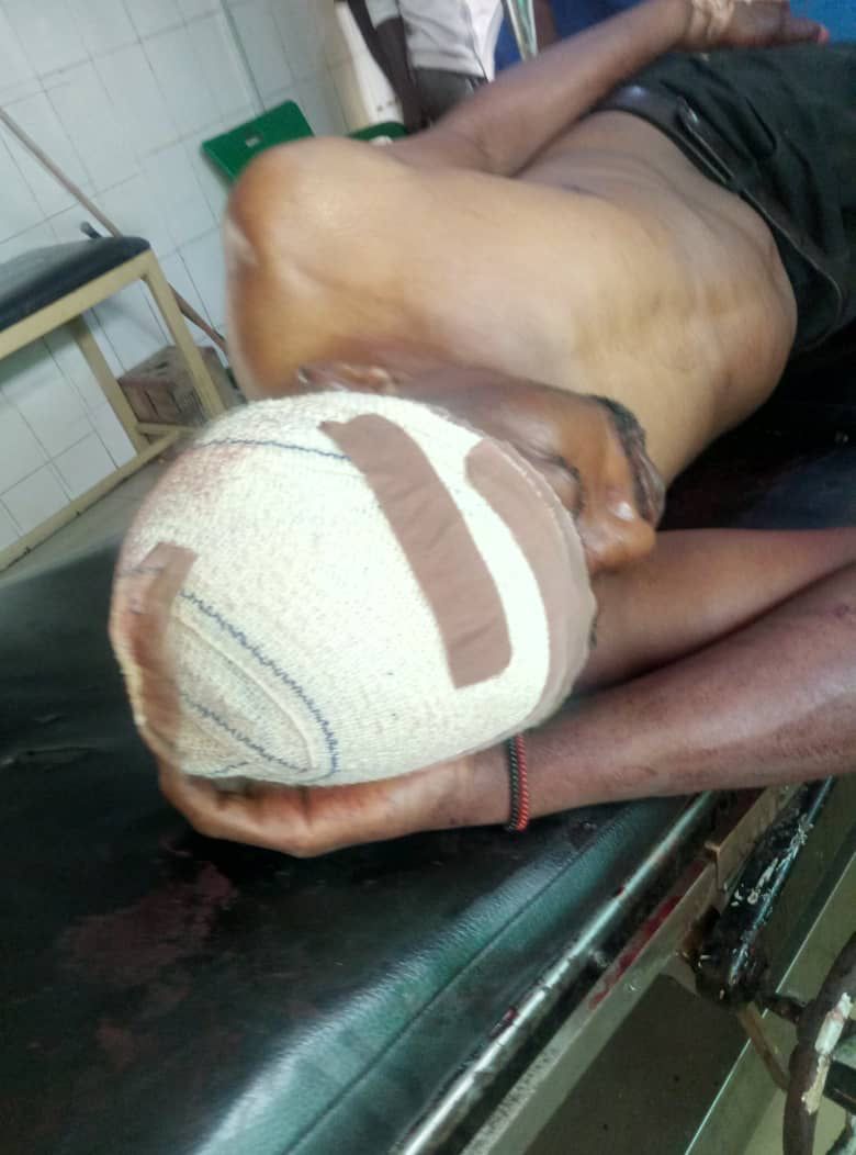 Unknown Assailants Attack 2/1 New Site Kubwa, Wound Scores (Graphic Pics) - Crime