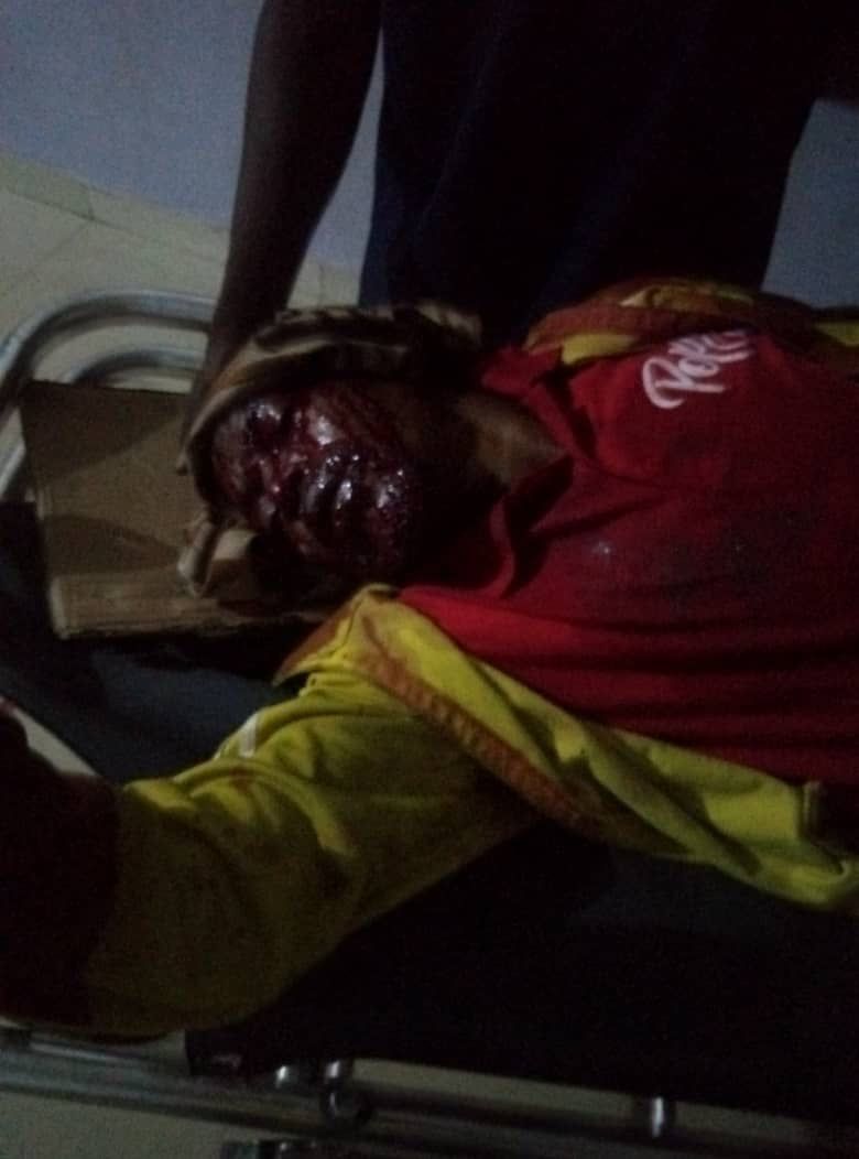 Unknown Assailants Attack 2/1 New Site Kubwa, Wound Scores (Graphic Pics) - Crime