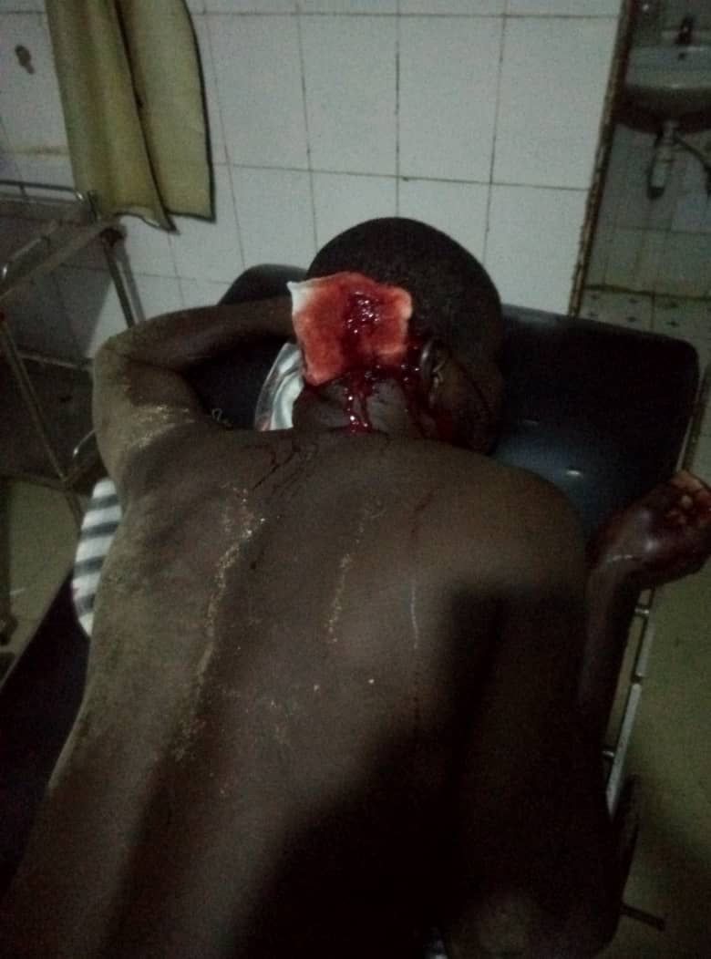 Unknown Assailants Attack 2/1 New Site Kubwa, Wound Scores (Graphic Pics) - Crime