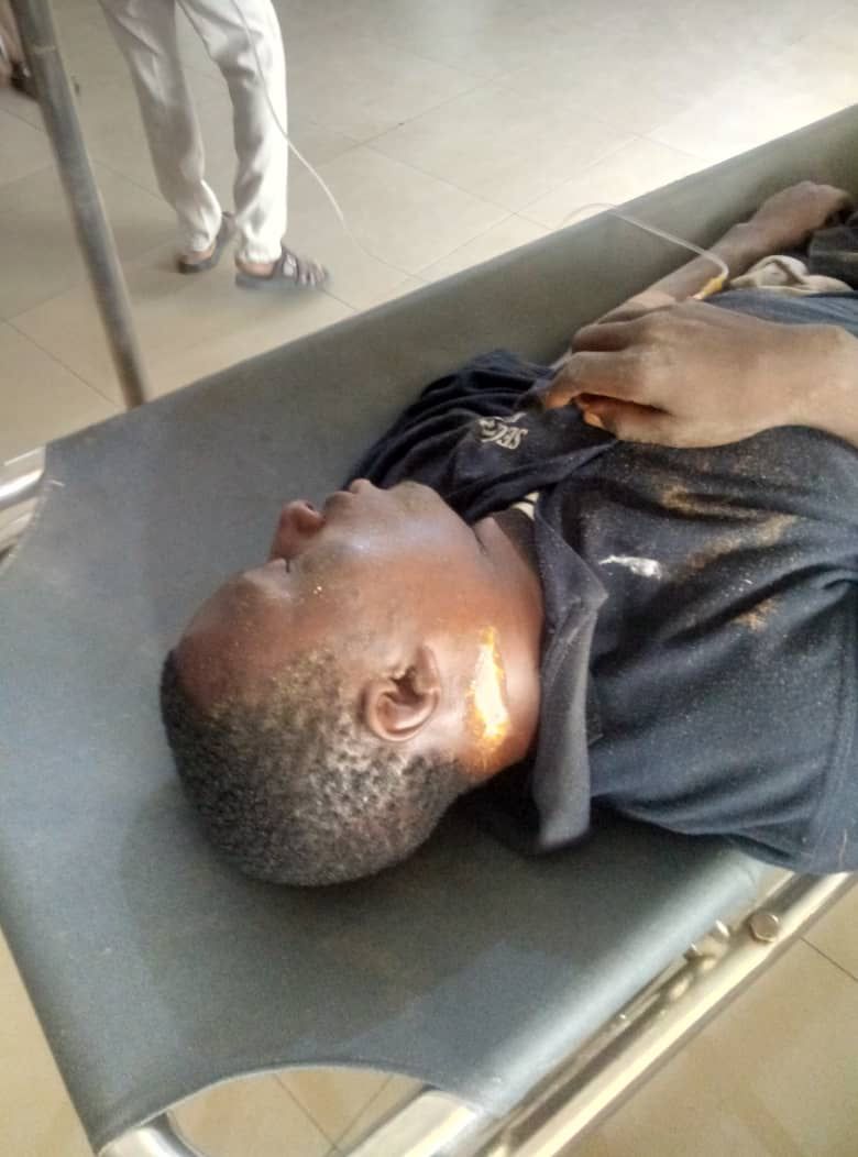 Unknown Assailants Attack 2/1 New Site Kubwa, Wound Scores (Graphic Pics) - Crime