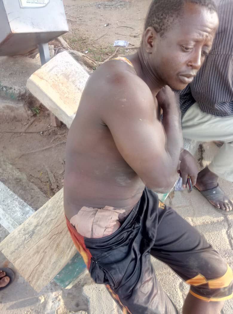Unknown Assailants Attack 2/1 New Site Kubwa, Wound Scores (Graphic Pics) - Crime