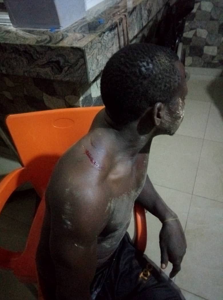 Unknown Assailants Attack 2/1 New Site Kubwa, Wound Scores (Graphic Pics) - Crime