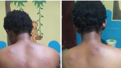 My husband wants to kill me” – Nigerian woman cries out for help over alleged domestic violence