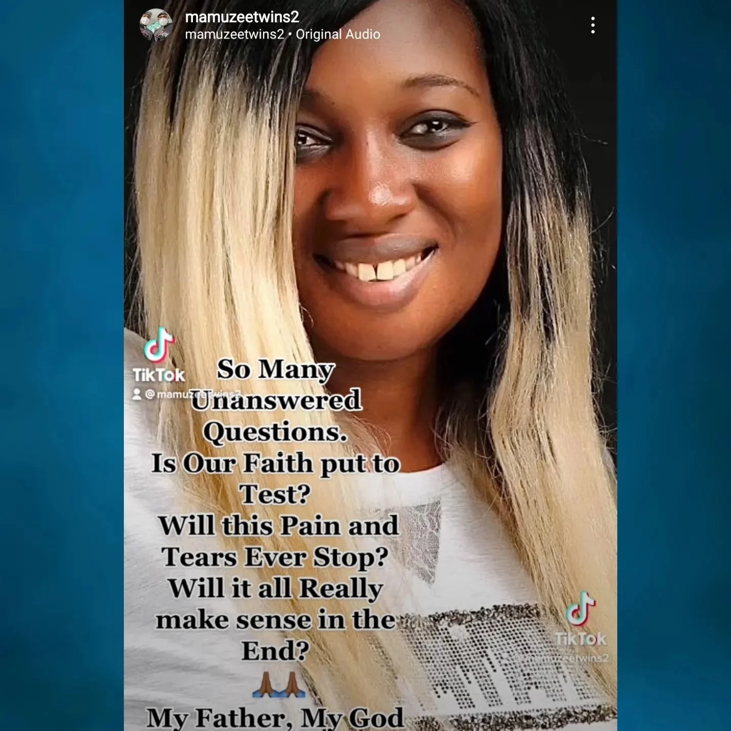 Painful: One of the  Mamuzee twins lost wife