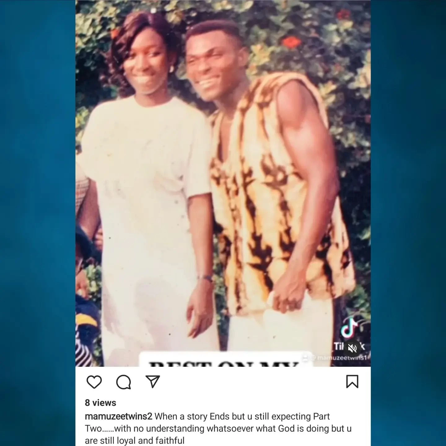 Painful: One of the  Mamuzee twins lost wife