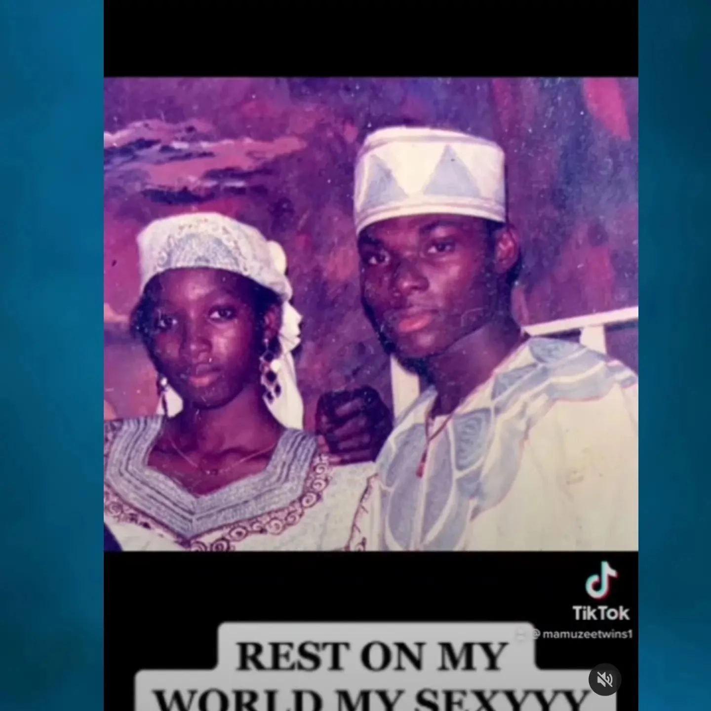 Painful: One of the  Mamuzee twins lost wife