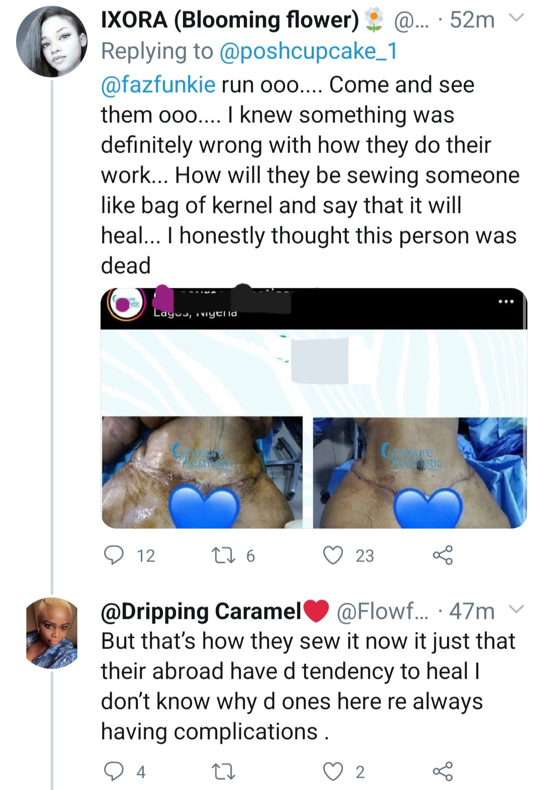 Friends mourn as woman dies in Nigerian clinic following 'botched cosmetic surgery'