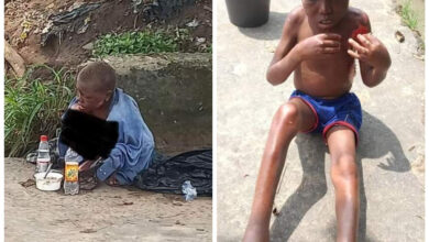 Little boy branded a witch and abandoned on streets of Uyo (graphic photos)