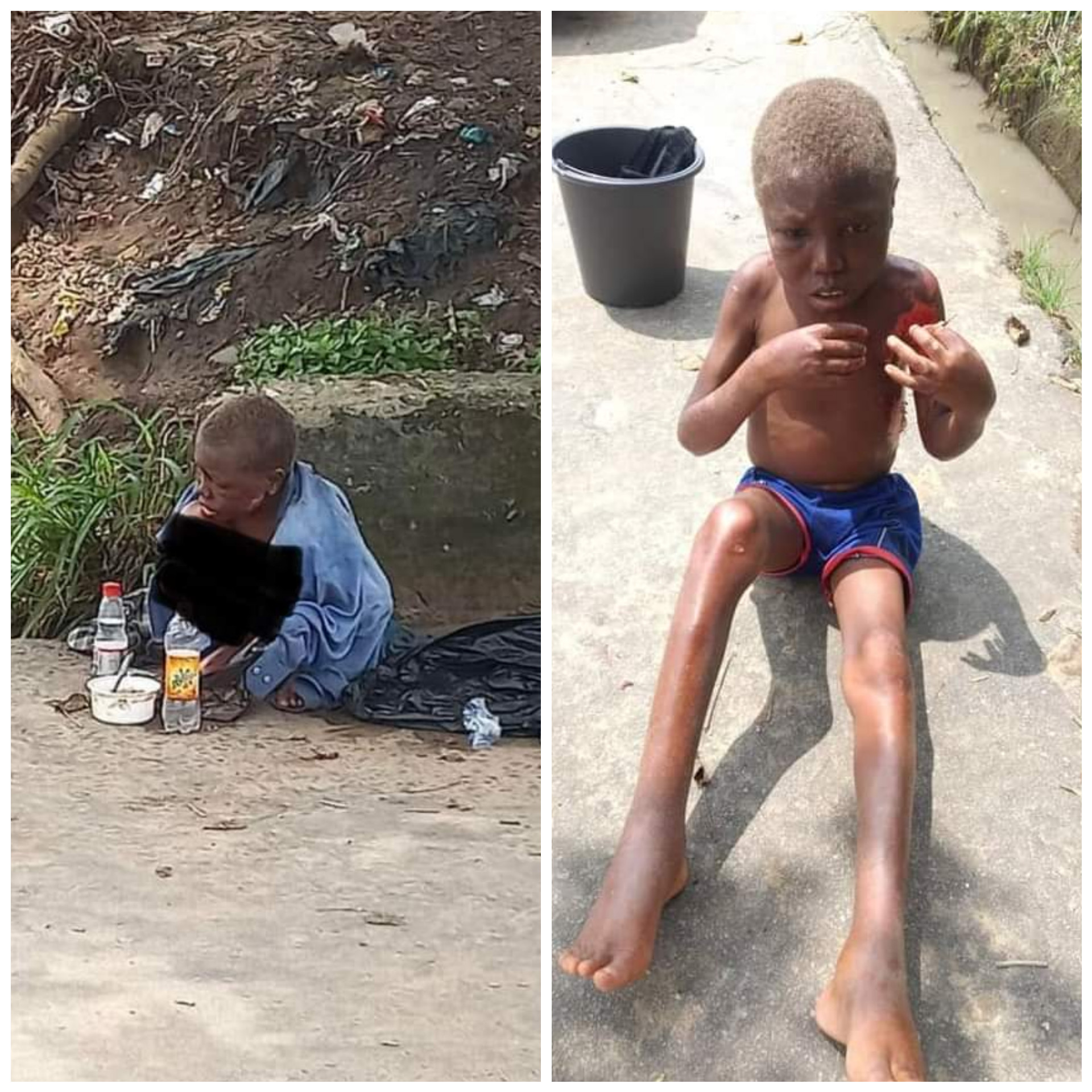 Little boy branded a witch and abandoned on streets of Uyo (graphic photos)