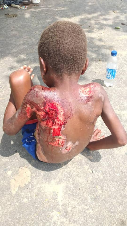 Little boy branded a witch and abandoned on streets of Uyo (graphic photos)