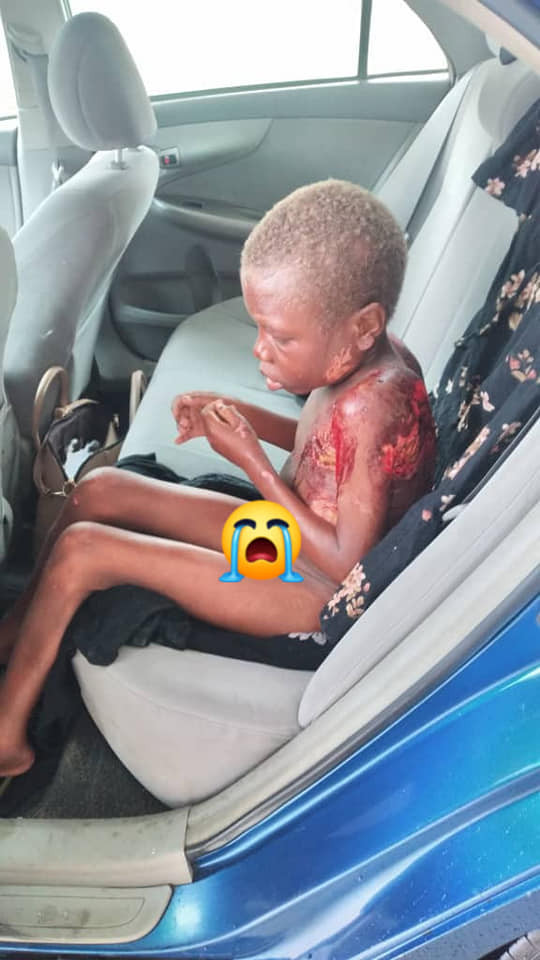 Little boy branded a witch and abandoned on streets of Uyo (graphic photos)