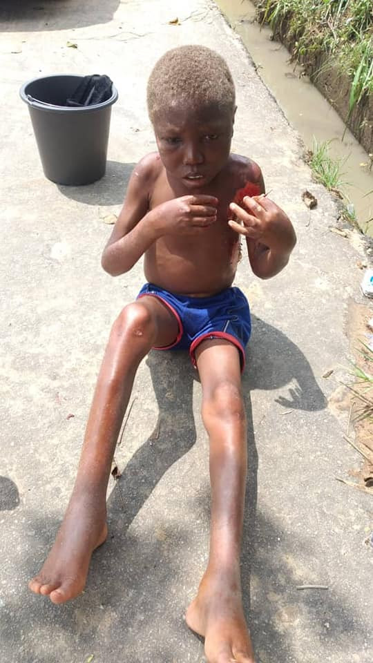 Little boy branded a witch and abandoned on streets of Uyo (graphic photos)
