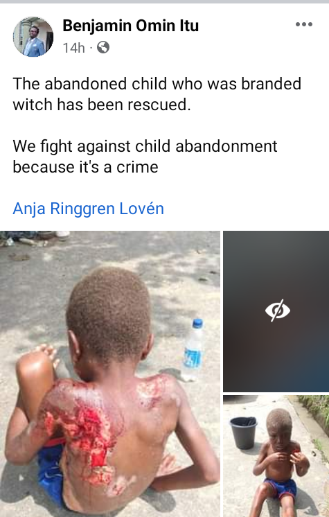 Little boy branded a witch and abandoned on streets of Uyo (graphic photos)