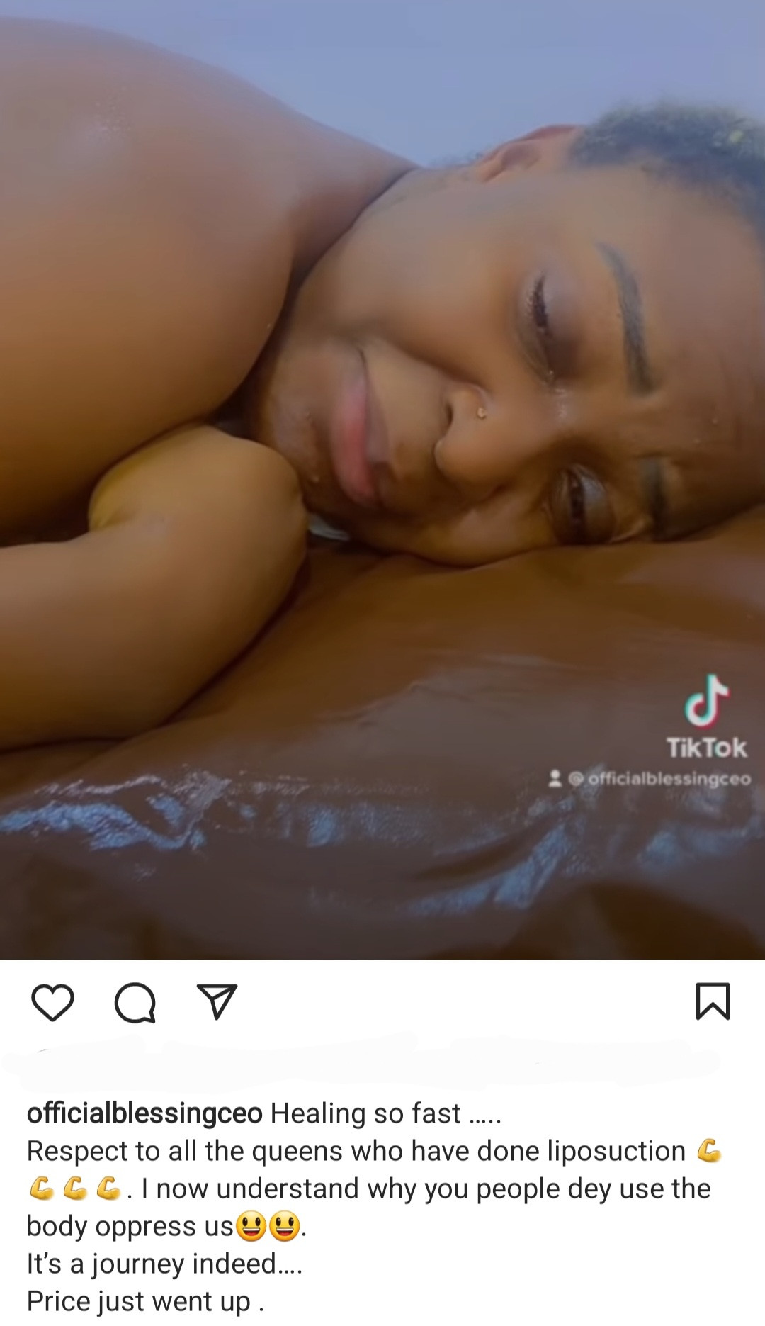 It's so painful" Blessing Okoro cries out in pain as she undergoes post-op care following liposuction surgery