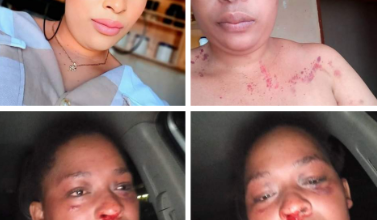 South African woman brutally beaten by her police officer boyfriend